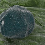 Polle unterm Elektronenmikroskop